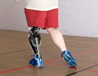 leg hubbles, tag heuer prosthetic leg