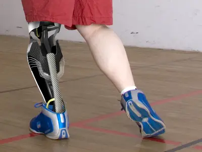 leg hubbles, tag heuer prosthetic leg