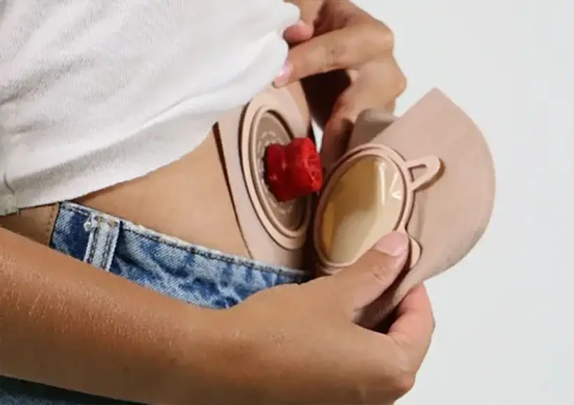 Odapt Silicone Wafer for Ostomy Bag by Jessica Nissen, Ivana Llobet, and Patricia López