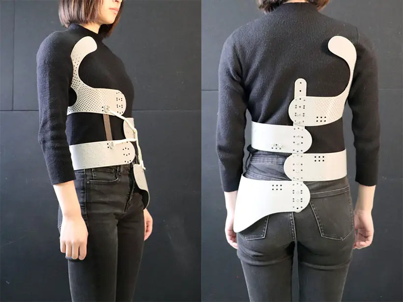 Airy Scoliosis Brace by Sangyu Xi