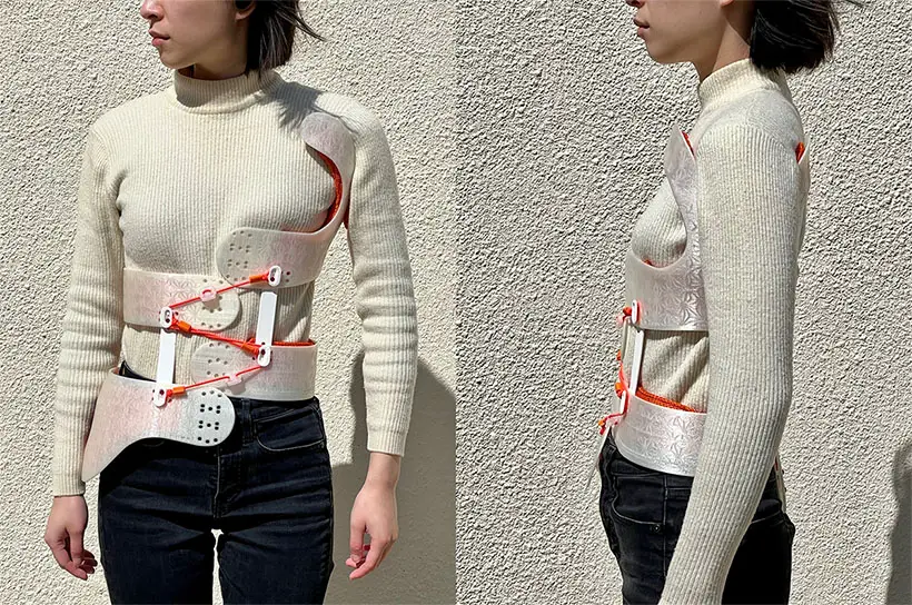 Airy Scoliosis Brace by Sangyu Xi