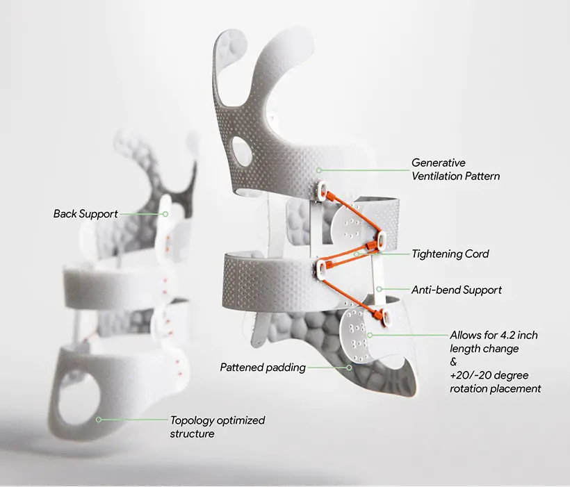 Airy Scoliosis Brace by Sangyu Xi