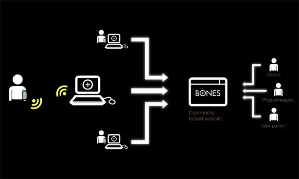 Bones Orthopedic Cast with Sensors by Pedro Nakazato Andrade