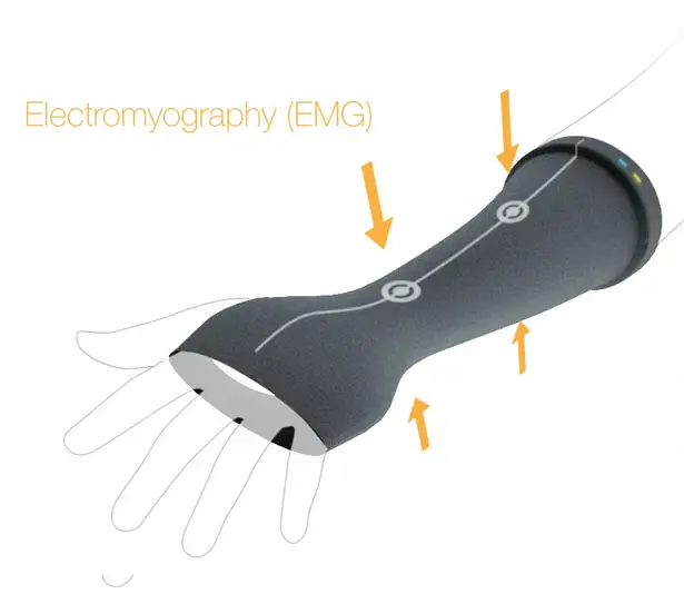 Bones Orthopedic Cast with Sensors by Pedro Nakazato Andrade