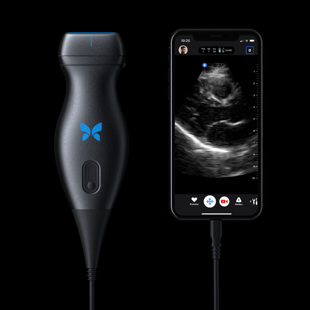 Butterfly IQ Personal Ultrasound