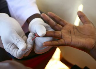 CATCH – Affordable and Easy to Use HIV Detector Concept for Developing Countries
