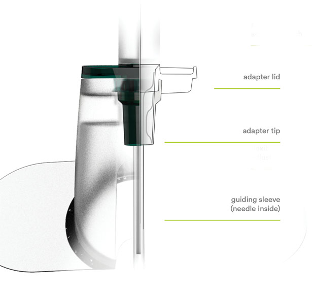 Cevec: Central Venous Catheter for Emergencies by Gabriel Mueller