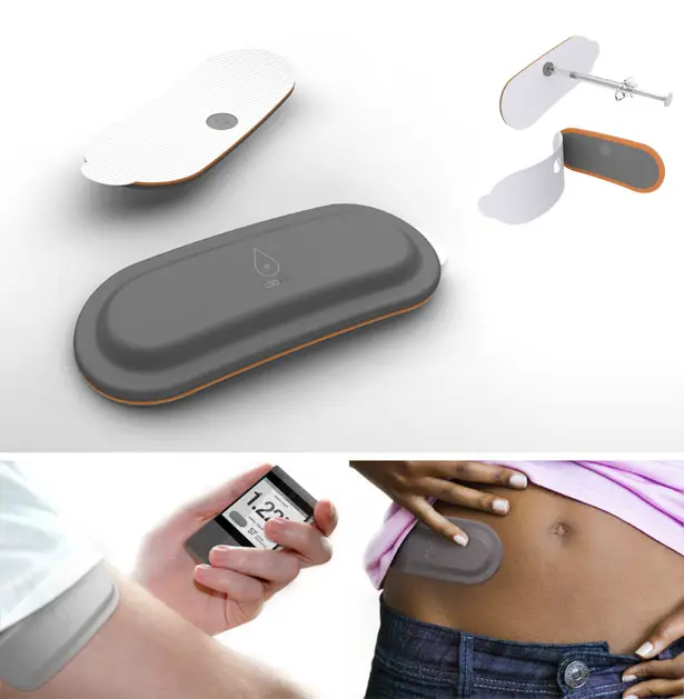 DibKit Diabetes Management System