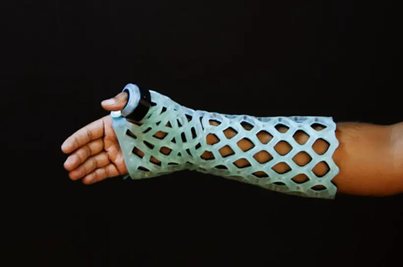 FlexiOH - Next Generation of Orthopedic Immobilizer Technology