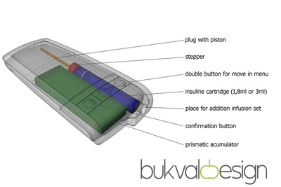 diabetes insulin pump