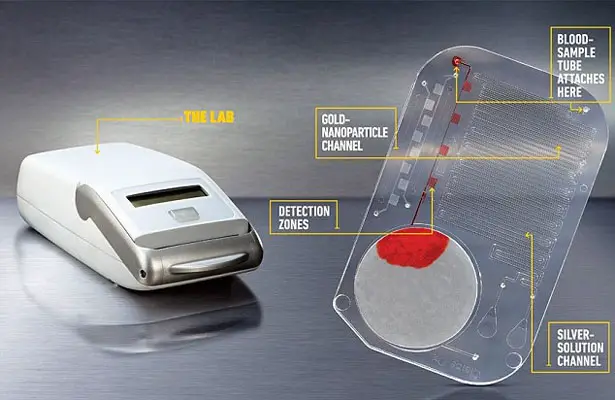 mChip : Credit Card Sized Portable Device Detects HIV in Minutes