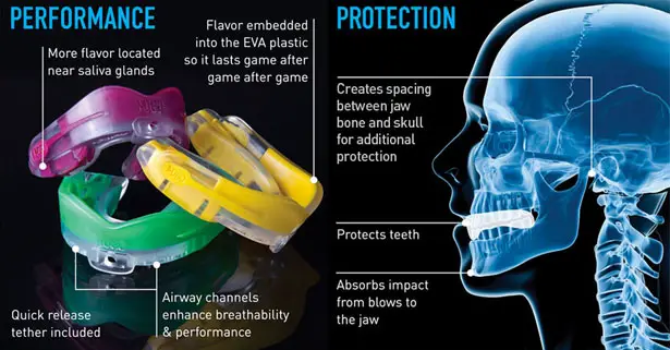 MOGO Flavored Mouthguard by James Lua