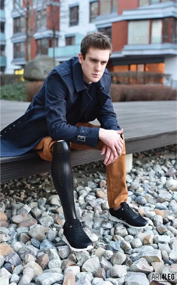 3D Printed Prosthetic Leg Cover Features Beautiful Form of Athletic Leg Muscles