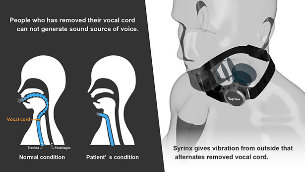 Syrinx Wearable Voice Box by Ahn Jaesol