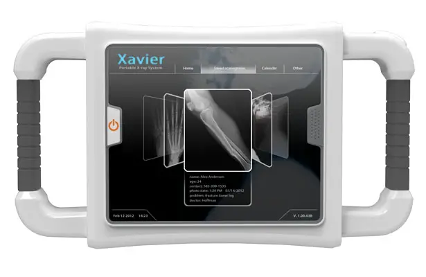 Xavier Portable X-Ray by Danwei Ye