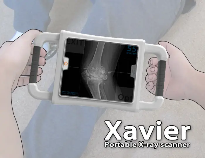 Xavier Portable X-Ray by Danwei Ye