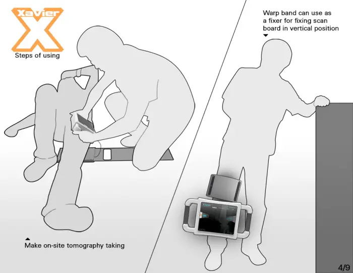 Xavier Portable X-Ray by Danwei Ye