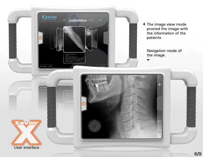 Xavier Portable X-Ray by Danwei Ye